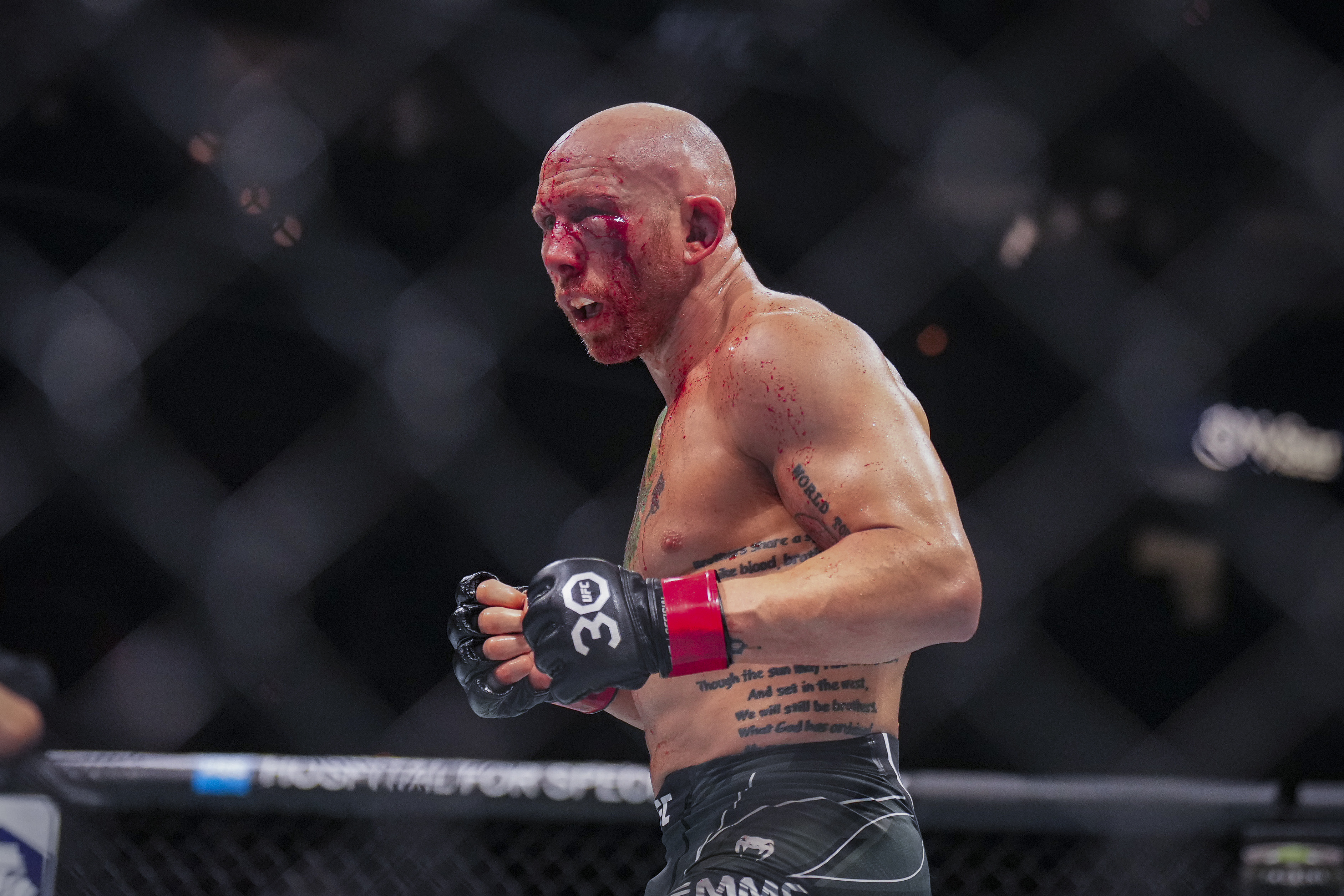 UFC Fight Night: americano fica com rosto completamente desfigurado