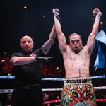 Whindersson Nunes choca com revela&ccedil;&atilde;o sobre dinheiro recebido no boxe