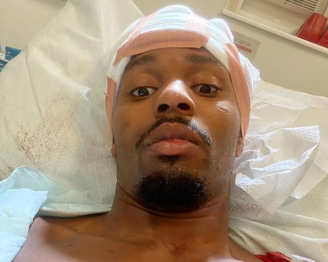 Lutador do UFC, Lerone Murphy internado no hospital ap&oacute;s acidente de tr&acirc;nsito. Foto: Reprodu&ccedil;&atilde;o/Instagram @lerone145
