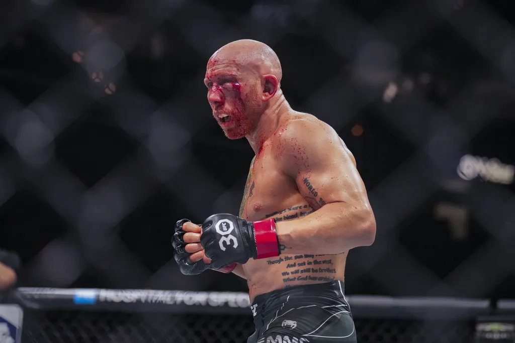 UFC Fight Night: americano fica com rosto completamente desfigurado